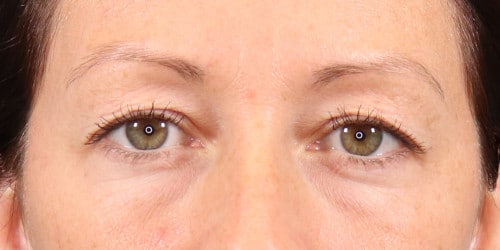 1762378359_3427-imageset_1-before